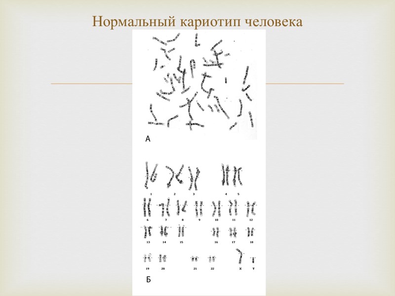 Нормальный кариотип человека